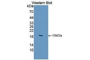 IL1F10 anticorps  (AA 15-152)