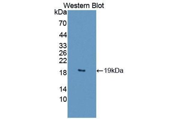 IL1F10 anticorps  (AA 15-152)
