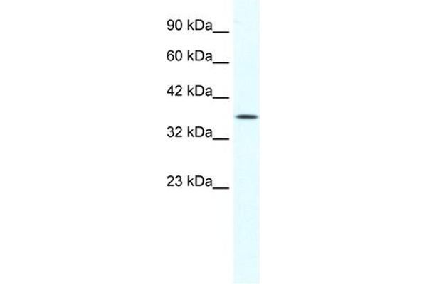 anti-Y Box Binding Protein 2 (YBX2) (Middle Region) antibody