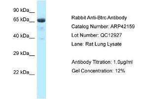 Image no. 1 for anti-beta-Transducin Repeat Containing (BTRC) (N-Term) antibody (ABIN2775272)