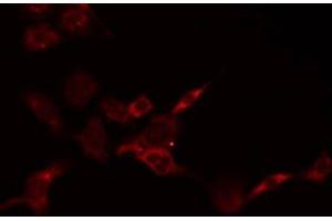 Image no. 1 for anti-Prostate Stem Cell Antigen (PSCA) antibody (ABIN6264443)