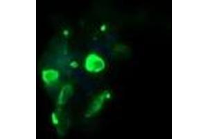 Image no. 1 for anti-Galactosidase, beta 1 (GLB1) antibody (ABIN5578846)