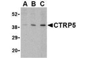 Image no. 1 for anti-C1q and Tumor Necrosis Factor Related Protein 5 (C1QTNF5) (Intermediate Domain) antibody (ABIN499675)