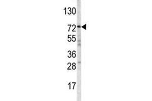 anti-ATP-Binding Cassette, Sub-Family G (WHITE), Member 1 (ABCG1) (AA 168-195) antibody