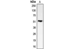 Image no. 2 for anti-Bone Morphogenetic Protein 5 (BMP5) (Center) antibody (ABIN2705603)