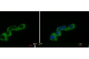 Image no. 1 for anti-Collagen, Type I, alpha 2 (COL1A2) (C-Term) antibody (ABIN2855530)