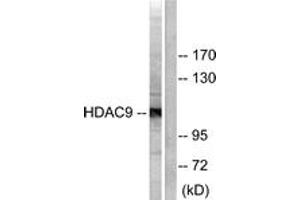 Image no. 1 for anti-Histone Deacetylase 9 (HDAC9) (AA 1017-1066) antibody (ABIN1533308)