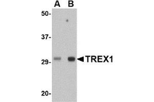 Image no. 2 for anti-three Prime Repair Exonuclease 1 (TREX1) (Center) antibody (ABIN501036)