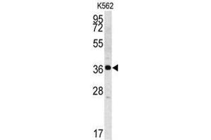 Image no. 1 for anti-Kallikrein 2 (KLK2) (C-Term) antibody (ABIN358874)