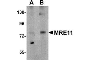 Image no. 2 for anti-MRE11 Meiotic Recombination 11 Homolog A (S. Cerevisiae) (MRE11A) (N-Term) antibody (ABIN500290)