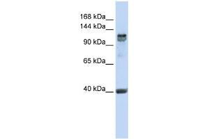 Image no. 1 for anti-Regulatory Factor X, 1 (Influences HLA Class II Expression) (RFX1) (C-Term) antibody (ABIN2792556)