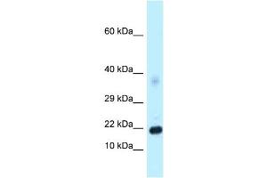 Image no. 1 for anti-Dickkopf Homolog 4 (Xenopus Laevis) (DKK4) (C-Term) antibody (ABIN2775398)