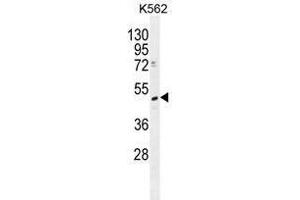 Image no. 2 for anti-tRNA Methyltransferase 2 Homolog B (TRMT2B) (AA 143-172), (N-Term) antibody (ABIN955334)