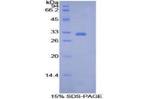 Image no. 1 for Pyruvate Dehydrogenase Kinase, Isozyme 4 (PDK4) (AA 73-316) protein (His tag) (ABIN1877525)