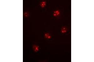 Image no. 2 for anti-Minichromosome Maintenance Complex Component 6 (MCM6) (full length) antibody (ABIN6043680)