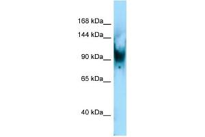 Image no. 1 for anti-SUMO1/sentrin Specific Protease 6 (SENP6) (C-Term) antibody (ABIN2784244)