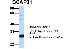 Image no. 3 for anti-B-Cell Receptor-Associated Protein 31 (BCAP31) (Middle Region) antibody (ABIN2782693)