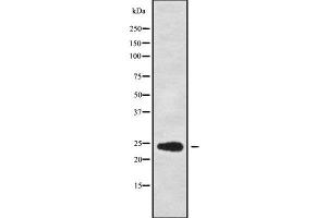 Image no. 1 for anti-Ribosomal Protein L13a (RPL13A) antibody (ABIN6264827)