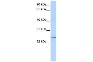 Image no. 1 for anti-RCAN Family Member 3 (RCAN3) (Middle Region) antibody (ABIN2779044)