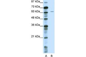 Image no. 2 for anti-Notch 4 (NOTCH4) (Middle Region) antibody (ABIN2777550)