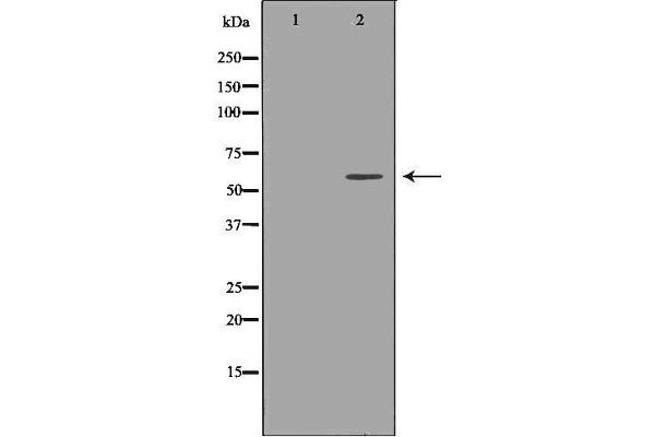 anti-UDP Glucuronosyltransferase 1 Family, Polypeptide A9 (UGT1A9) (C-Term) antibody