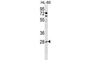 Image no. 2 for anti-Ras Homolog Gene Family, Member B (RHOB) (AA 103-137), (Middle Region) antibody (ABIN954540)