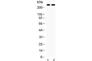 Image no. 1 for anti-ATP-Binding Cassette, Sub-Family A (ABC1), Member 4 (ABCA4) (AA 1890-1927) antibody (ABIN5647438)