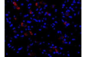 Image no. 5 for anti-NLR Family, Pyrin Domain Containing 3 (NLRP3) (AA 15-120) antibody (ABIN1386361)