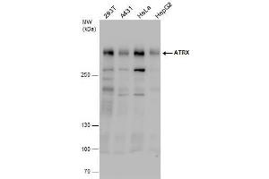WB Image ATRX antibody detects ATRX protein by western blot analysis.