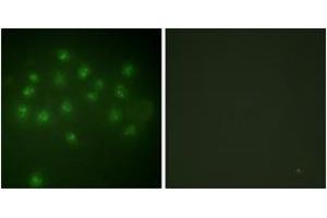 Immunofluorescence analysis of A549 cells, using Vitamin D Receptor (Phospho-Ser208) Antibody.