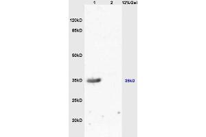 Image no. 1 for anti-Melanocortin 1 Receptor (MC1R) (AA 271-317) antibody (ABIN686287)