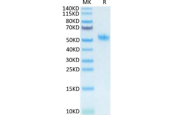 Osteopontin Protein (His tag)