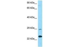 Image no. 1 for anti-Protease, serine, 58 (PRSS58) (AA 122-171) antibody (ABIN6748388)