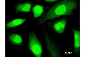Immunofluorescence of monoclonal antibody to SP140 on HeLa cell.