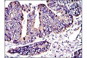 Image no. 4 for anti-V-Crk Sarcoma Virus CT10 Oncogene Homolog (Avian) (CRK) antibody (ABIN969062)