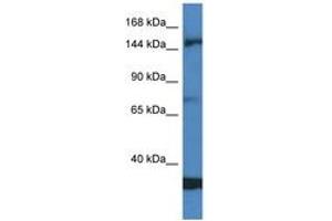Image no. 1 for anti-Eukaryotic Translation Initiation Factor 5B (EIF5B) (AA 557-606) antibody (ABIN6747454)