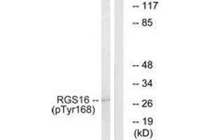 Western blot analysis of extracts from COS7 cells treated with heat shock, using RGS16 (Phospho-Tyr168) Antibody.