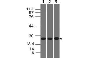 Image no. 1 for anti-ES cell expressed Ras (ERAS) (AA 1-210) antibody (ABIN5027194)