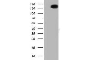 Image no. 1 for anti-L1 Cell Adhesion Molecule (L1CAM) antibody (ABIN1499086)