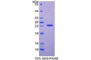 Image no. 1 for Adenine Phosphoribosyltransferase (APRT) (AA 1-180) protein (His tag) (ABIN1879347)