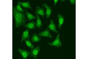 Image no. 2 for anti-CDC5 Cell Division Cycle 5-Like (S. Pombe) (CDC5L) antibody (ABIN6138265)