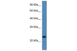 Image no. 1 for anti-Signal Sequence Receptor, beta (Translocon-Associated Protein Beta) (SSR2) (C-Term) antibody (ABIN928084)