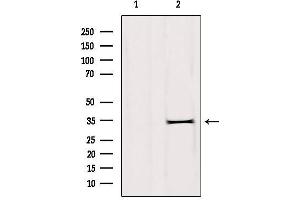 Image no. 2 for anti-Dehydrogenase/reductase (SDR Family) Member 1 (DHRS1) (Internal Region) antibody (ABIN6261287)