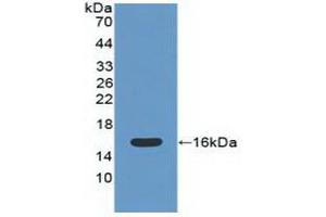 Catalase Antikörper  (AA 32-157)