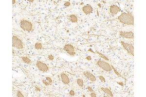 Immunohistochemistry analysis of paraffin-embedded mouse brain using MBP Polyclonal Antibody at dilution of 1:300.