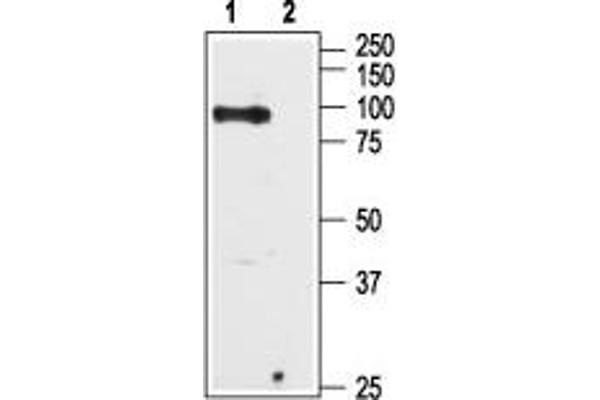 TRPV6 antibody  (C-Term, Intracellular)