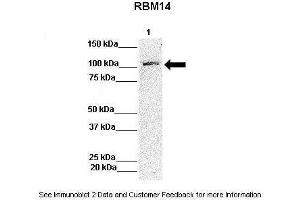 Image no. 2 for anti-RNA Binding Motif Protein 14 (RBM14) (N-Term) antibody (ABIN2780024)