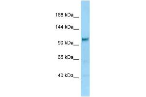 Image no. 1 for anti-Diaphanous Homolog 2 (DIAPH2) (C-Term) antibody (ABIN2788882)