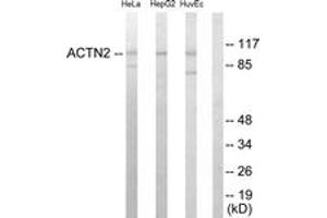 anti-Actinin, alpha 2/3 (ACTN2/3) (AA 31-80) antibody