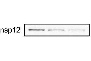 Image no. 1 for anti-SARS-CoV-2 RNA-dependent RNA Polymerase (NSP12) (SARS-CoV-2 RdRP) (C-Term) antibody (ABIN6992285)